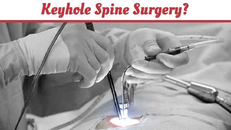 keyhole-spine-surgery-expertise-of-dr-vijay-mahantesh-pujari-in-hubballi-thumbnail