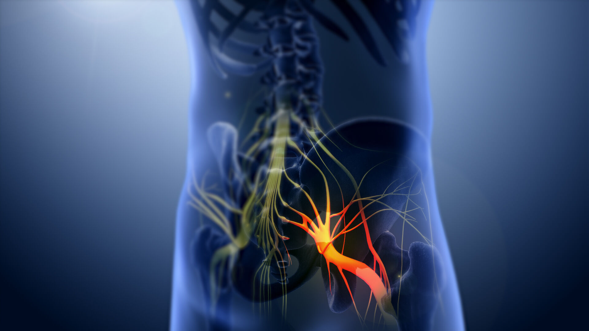 sciatica-causes-symptoms--treatments-by-dr-vijaymahantesh-pujari--leading-neurosurgeon-in-hubli-thumbnail